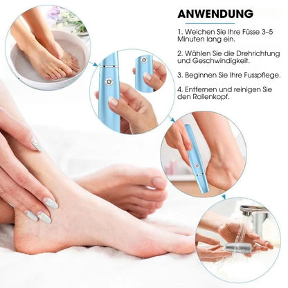 CalluCare™ – Elektrischer Hornhautentferner