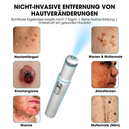 DermaLight Pro™ – Nicht-invasiver Laserstift für Muttermale, Warzen und Hautanhängsel