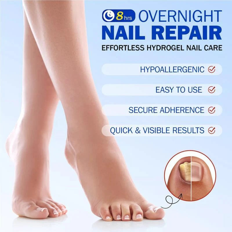 FUNGEX™ – Nagelpflaster gegen Nagelpilz